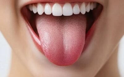 Mengapa Lidah Bisa Menjadi “Cermin” Kesehatan Gigi dan Tubuh Anda?