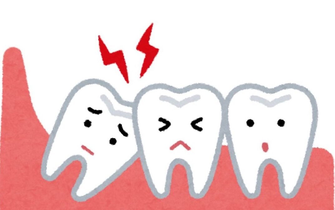 Rahasia Gigi Bungsu : Jejak Evolusi yang Kini Jadi Masalah Modern