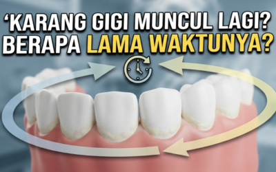 Berapa Lama Karang Gigi Terbentuk Kembali Setelah Scaling?