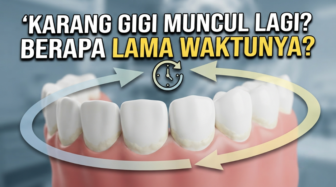 karang gigi